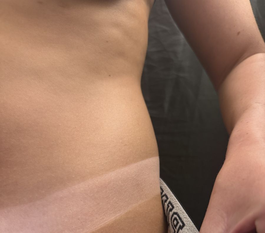 Spray tan line result