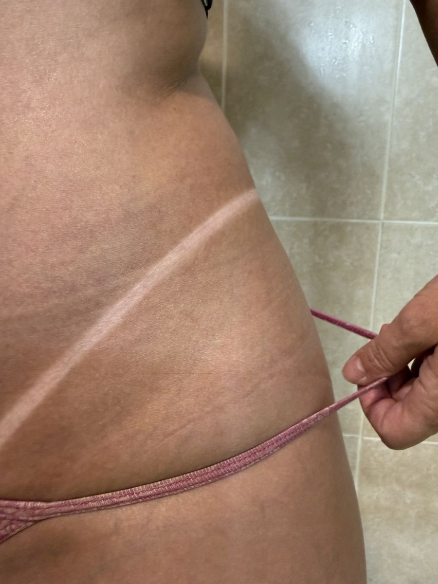 Spray tan line result