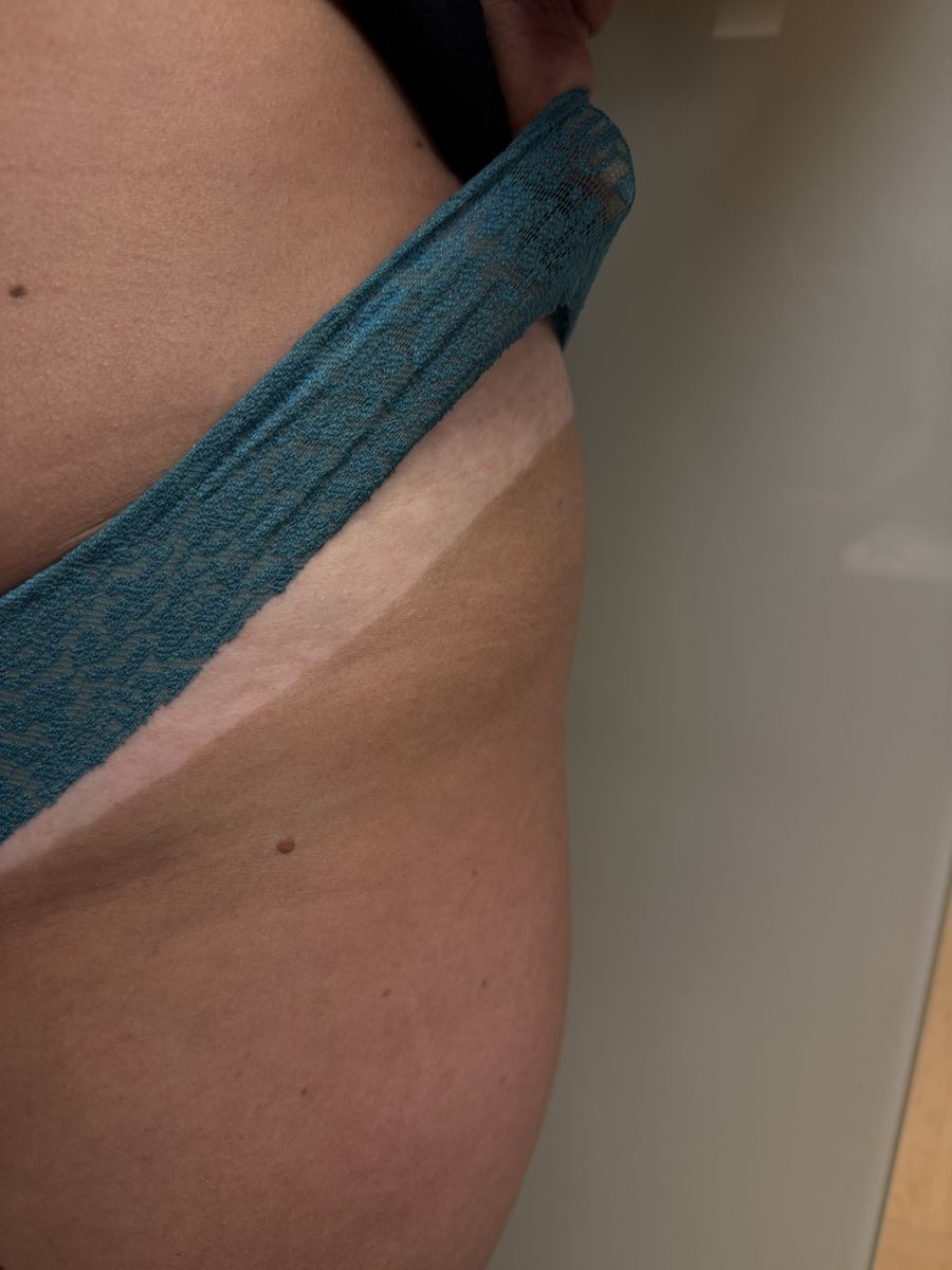 Spray tan line result