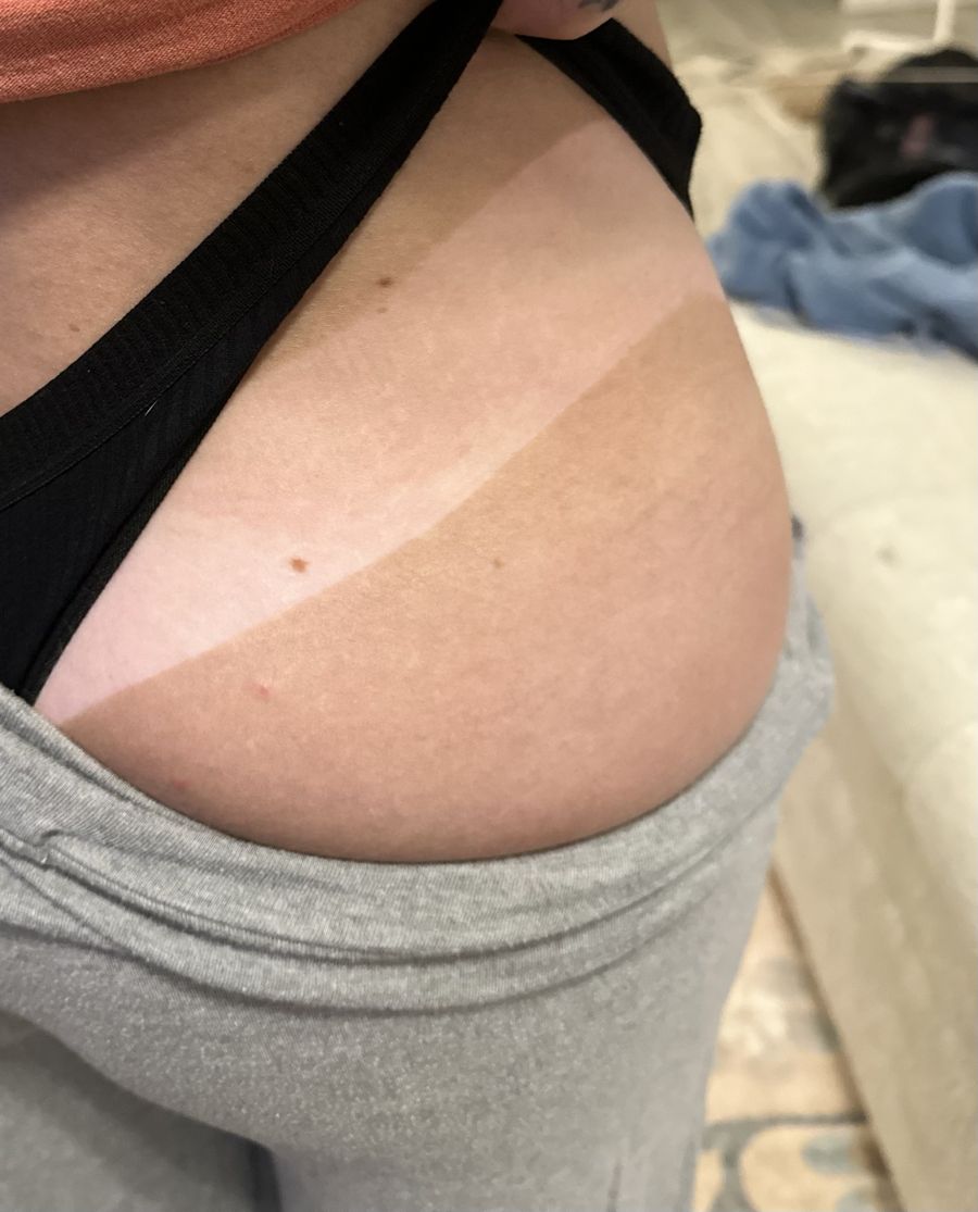 Spray tan line result