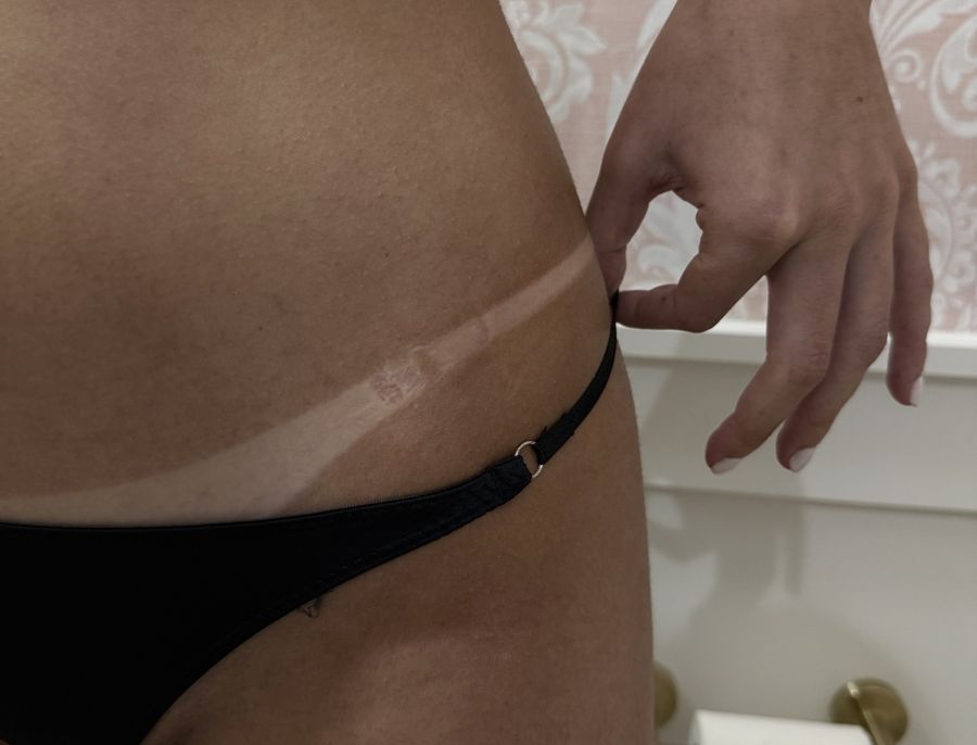 Spray tan line result