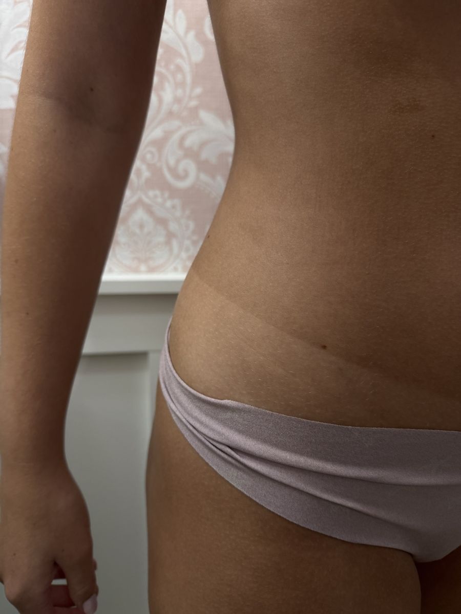 Spray tan line result