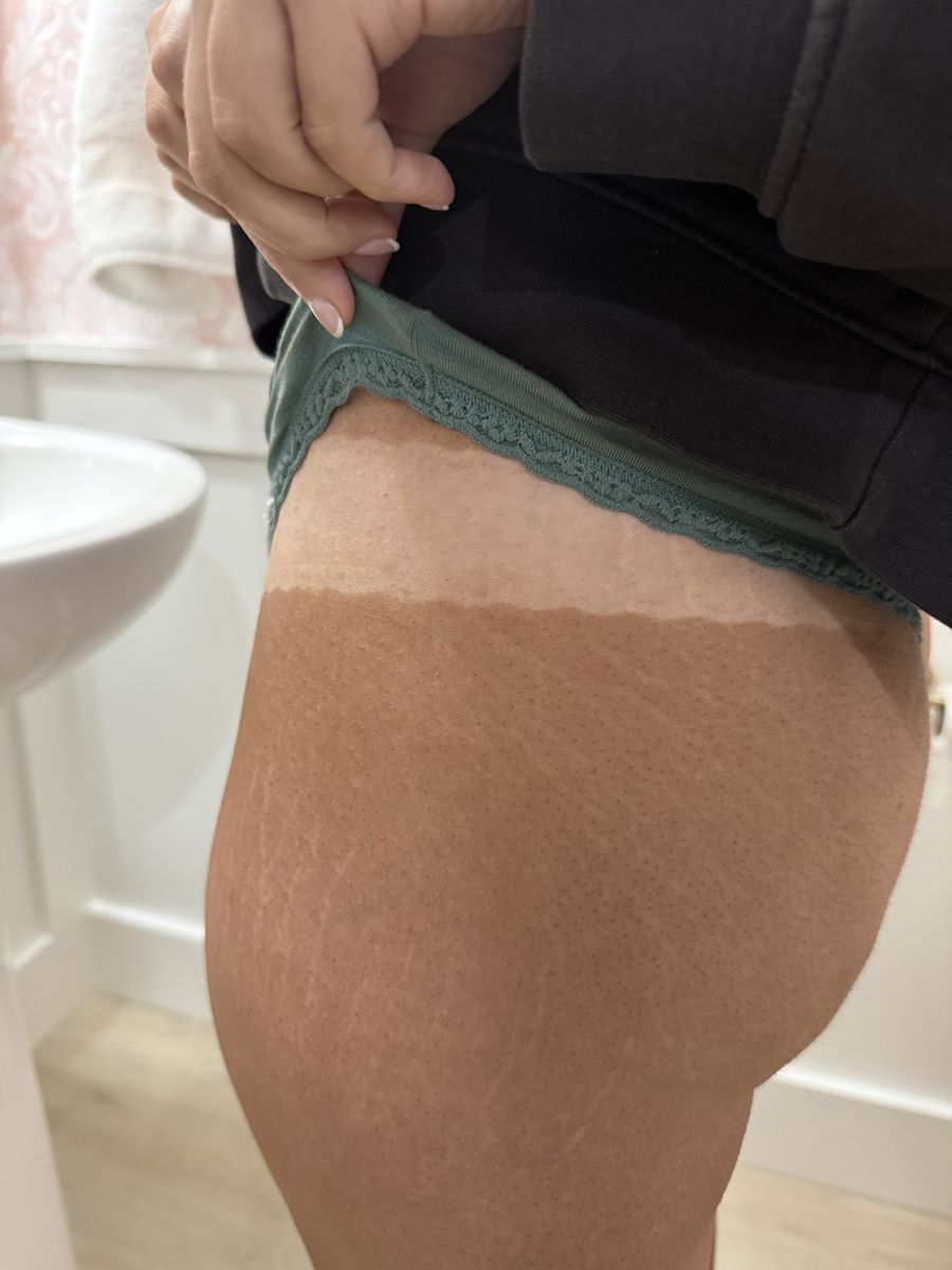 Spray tan line result